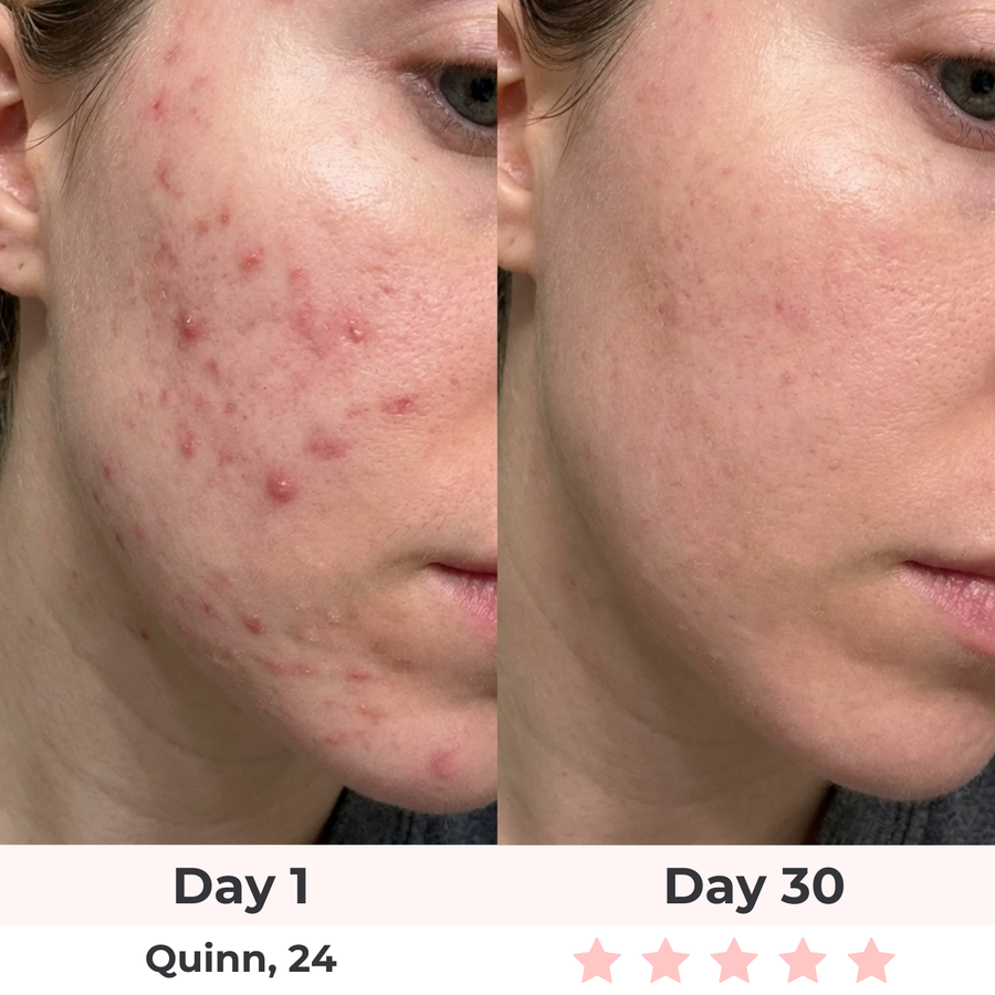 Expensive facials, fading results.