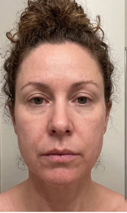 Before - Day 0