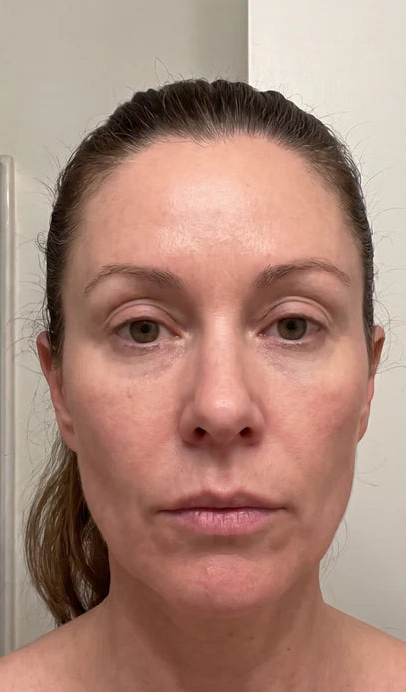 After - Day 30